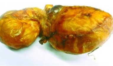  牛黄是怎来的，有哪些功效作用