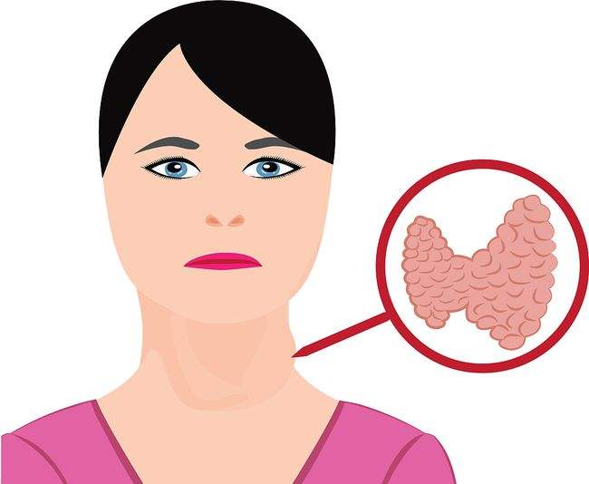 甲亢不能吃辣椒