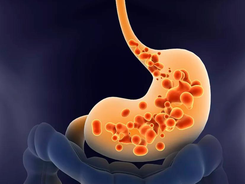 过量服用导致伤胃 过量服用导致伤胃